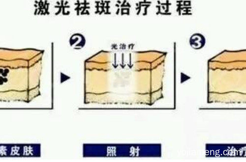 有什么可以去斑的吗？曲中周祛斑招商加盟怎样