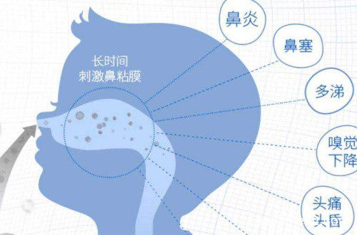 鼻炎店招商连锁加盟怎样？鼻炎店加盟靠谱吗